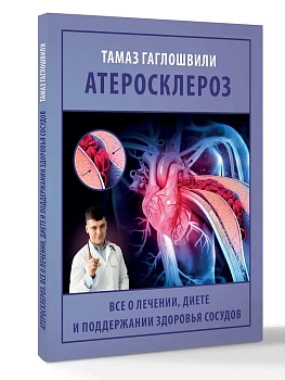 Атеросклероз. Все о лечении, диете и поддержании здоровья сосудов - купить в магазине Кассандра, фото, 9785171731861, 